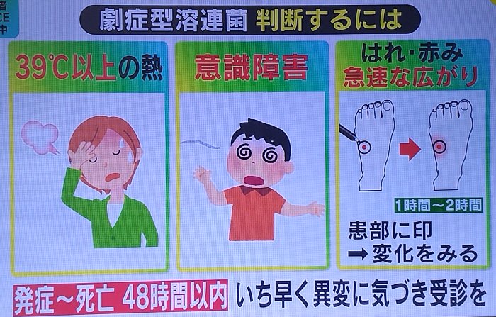 人食いバクテリア症状と対策